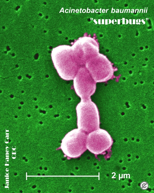acinetobacter baumannii